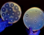 A szervezet antibiotikumai segíthetik a küzdelmet a jövő szuperbaktériumai ellen