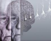 A demenciát korai fázisban kiszűrő szoftvert fejlesztenek magyar kutatók